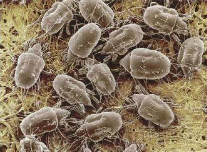 How to Get Rid of Dust Mites