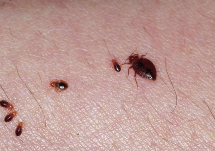 How to Get Rid of Bed Bugs