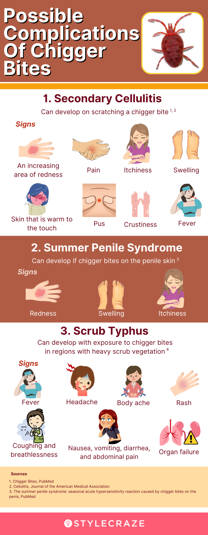 Illustrative image for get rid of chiggers in the house