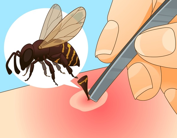 Illustrative image for gets rid of bees and wasps