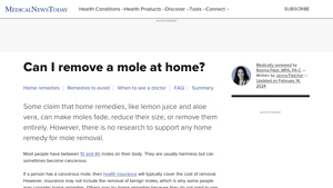 Medical News Today - Home Remedies for Mole Removal