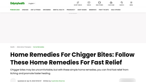 OnlyMyHealth - Home Remedies for Chigger Bites