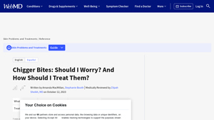 WebMD - Anti-Itch Solutions