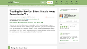 WikiHow - No-See-Um Bite Relief
